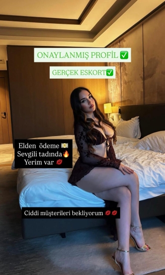 BERNA✅️